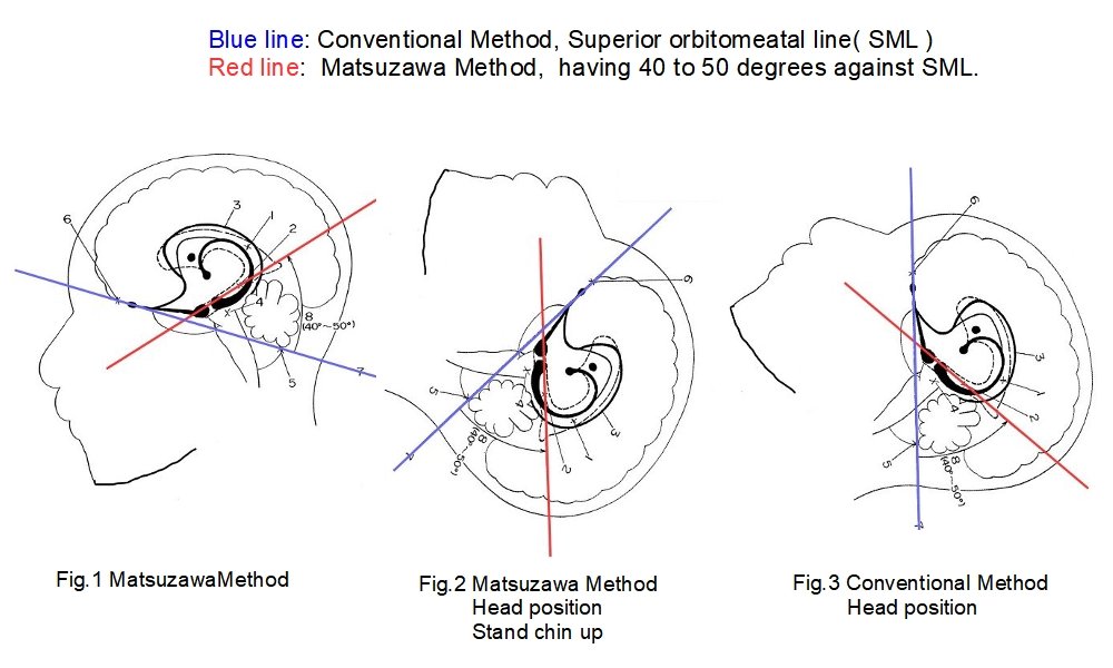 Figure 1: Comparison with Matsuzawa method and conventional imaging methods